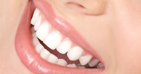 درمان بی دندانی با ایمپلنت